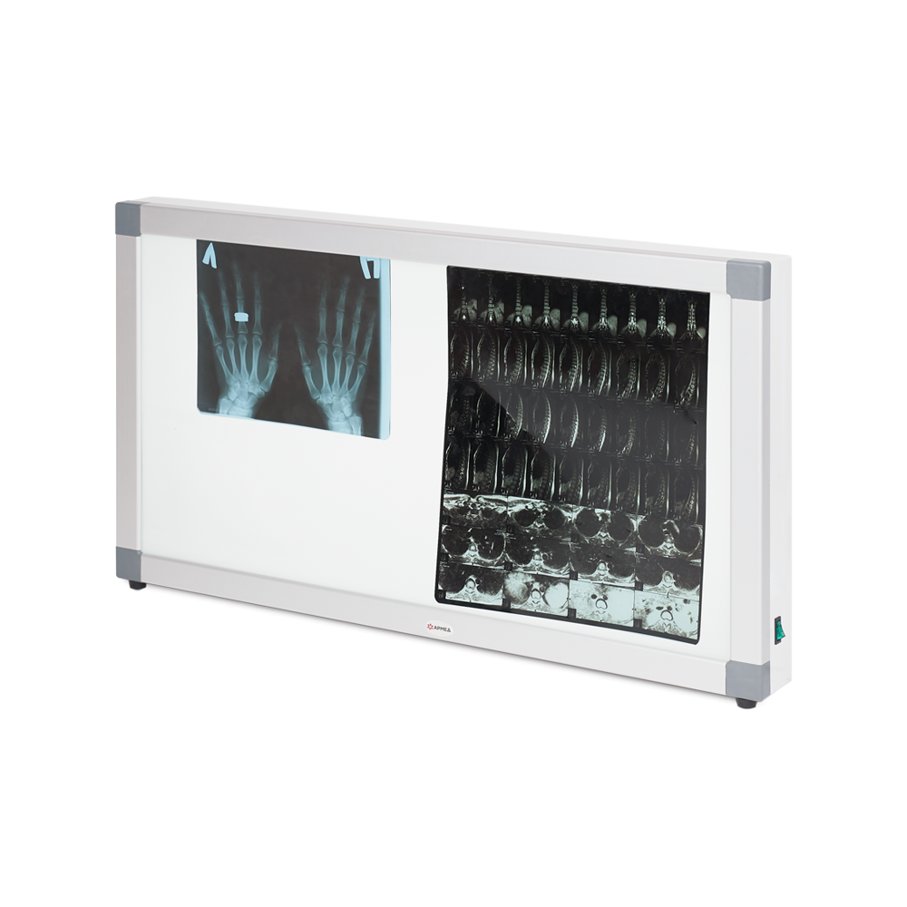 Негатоскоп общего назначения Армед 2-кадровый 