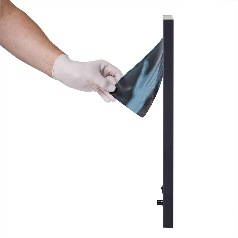 Негатоскоп общего назначения Армед 1-кадровый LUX 